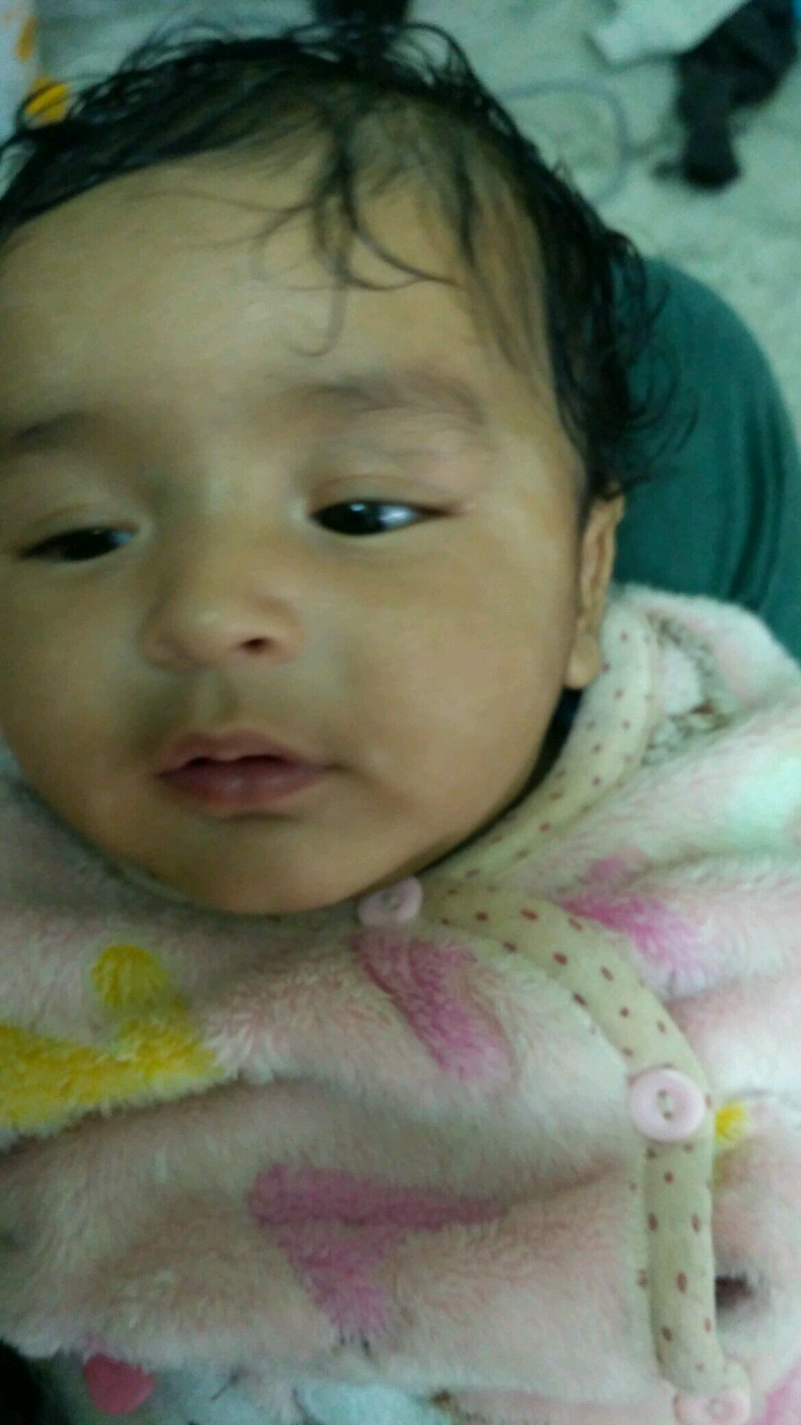 hi my 4 month old son white spot on his face light spots on baby face