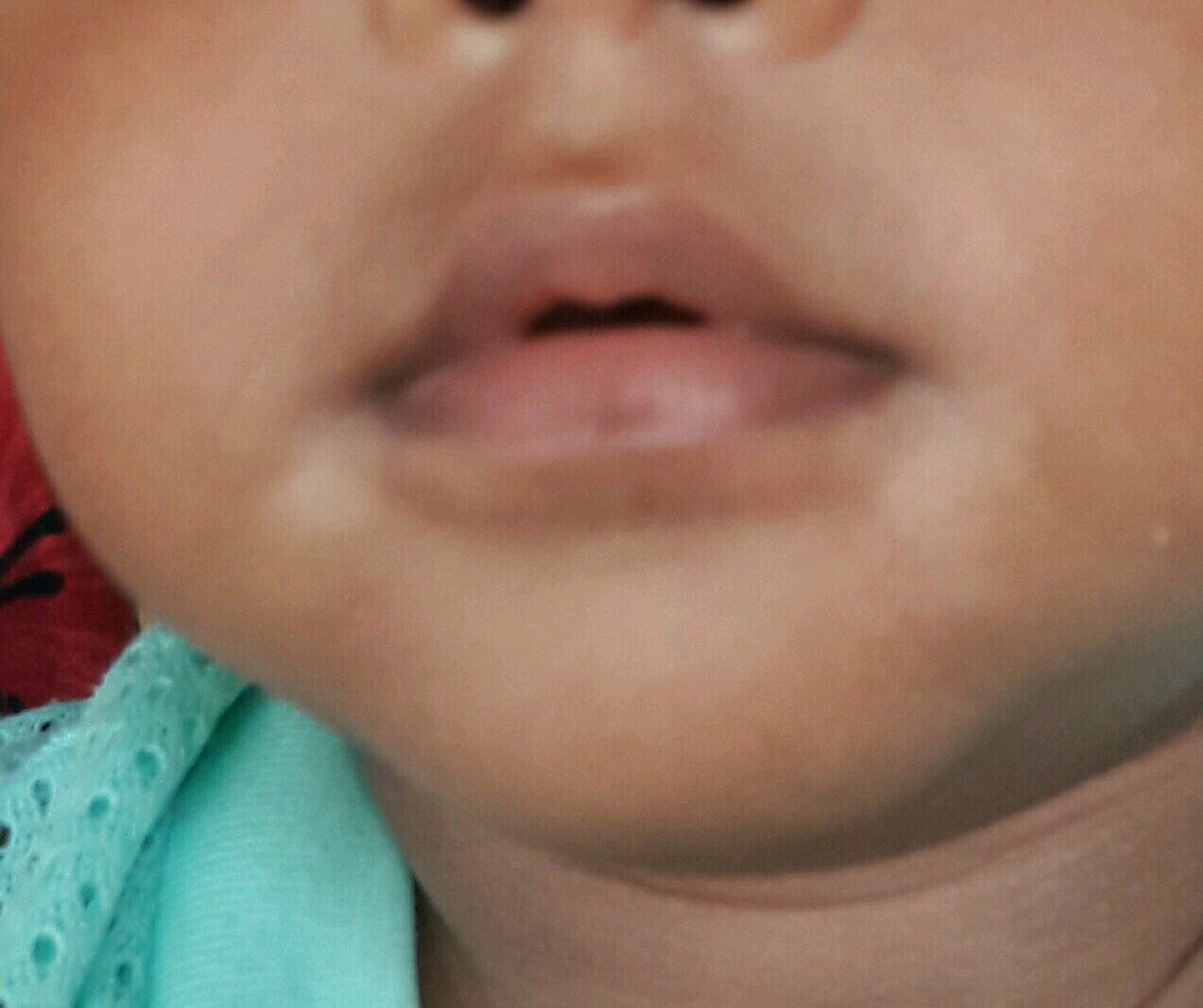 Veterinary Practice: White Area concerning Mouth